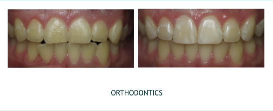 Orthodontics